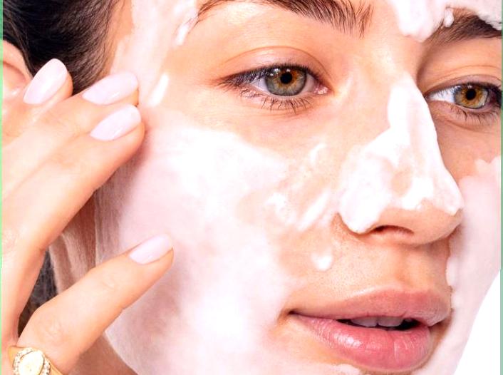 How to Manage Hormonal Acne