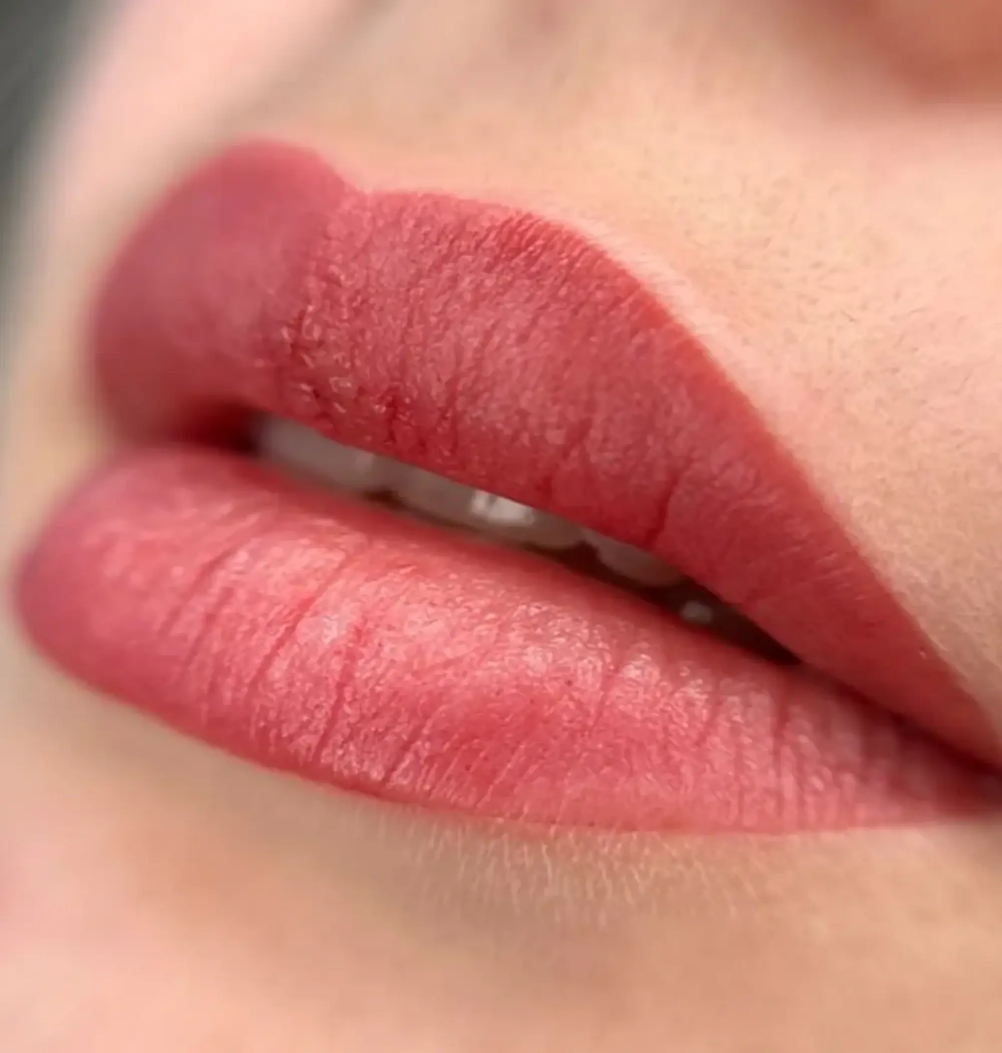 before and after lip blush correction