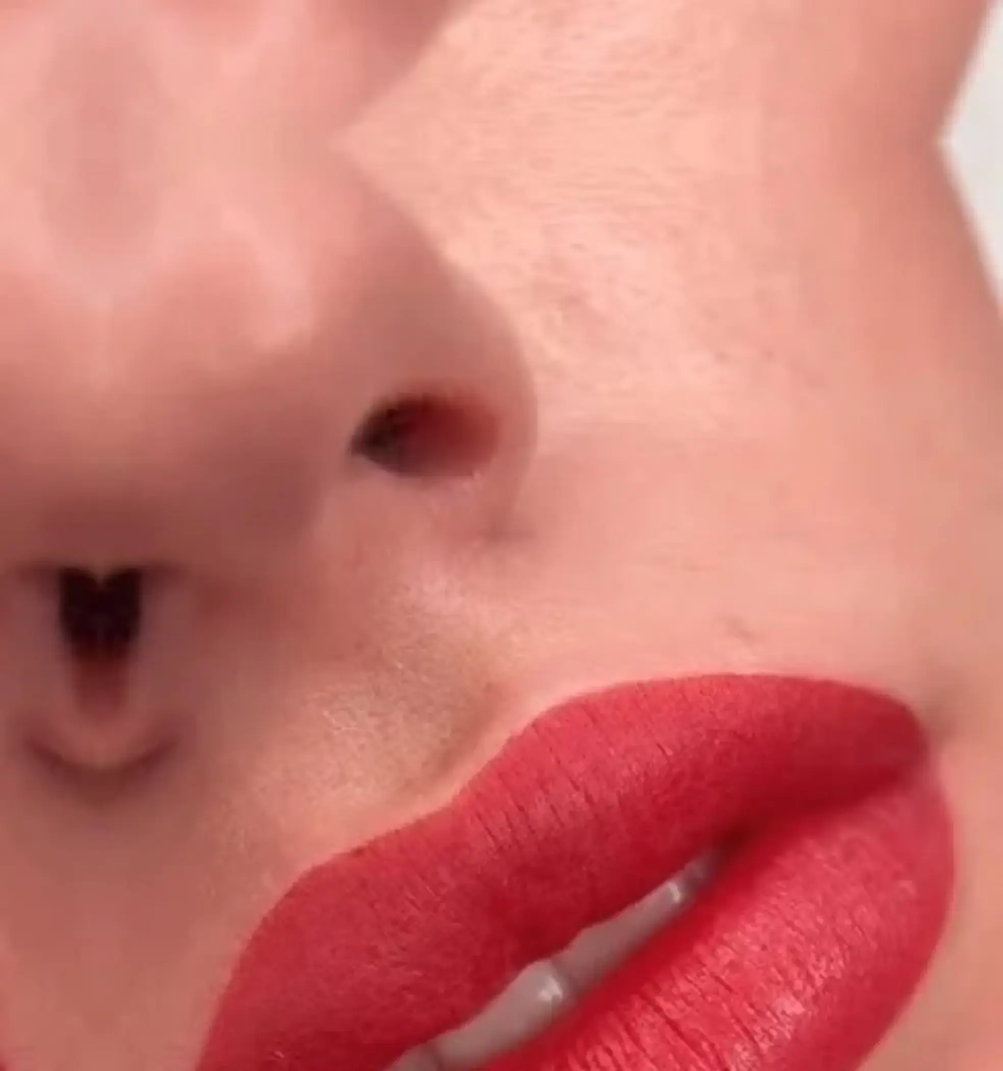 Lip Blush Fordyce Spots: Can It Hide Them?