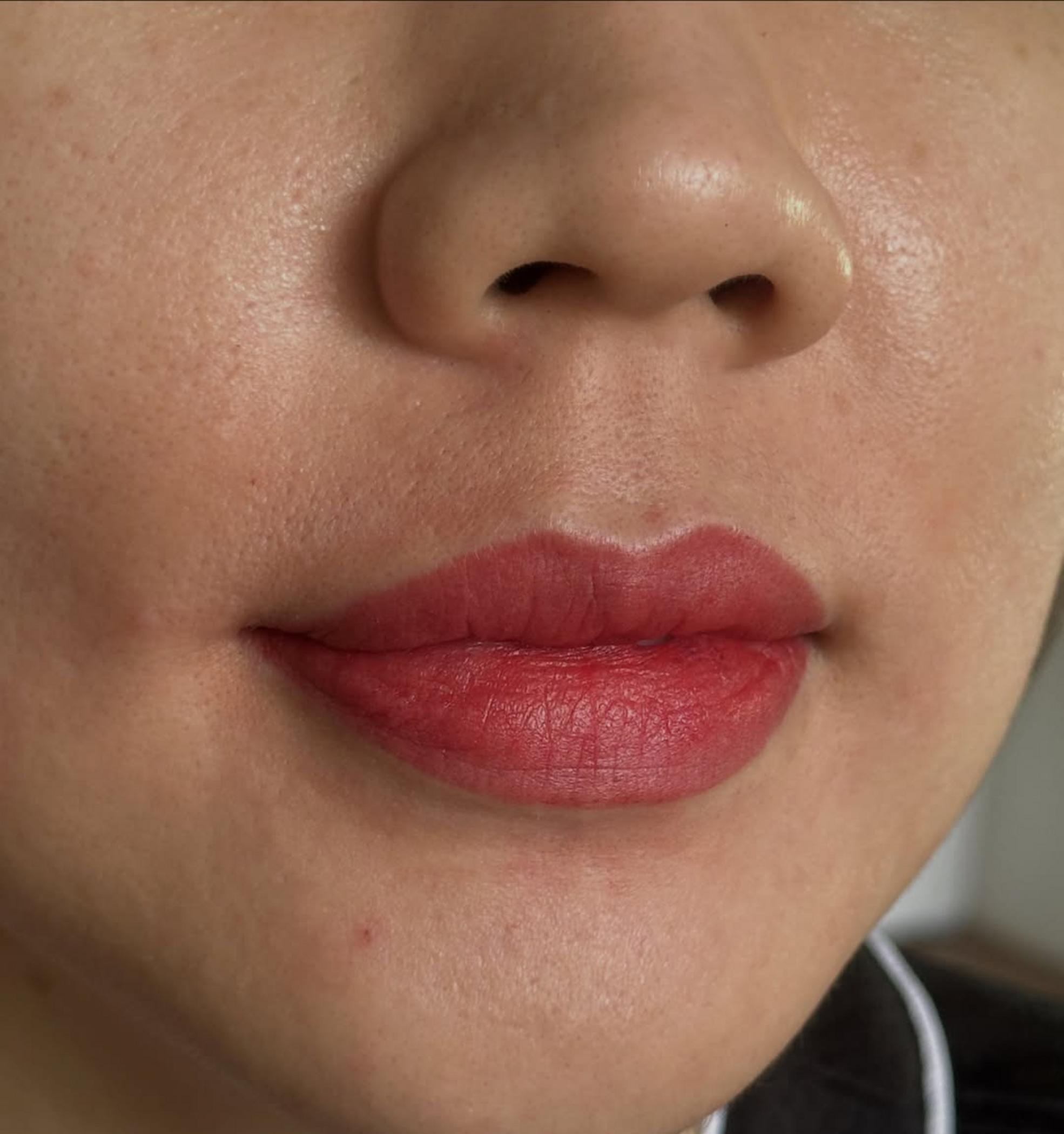 Can You Get Lip Blush For Scars Or Medical Lip Restorations?