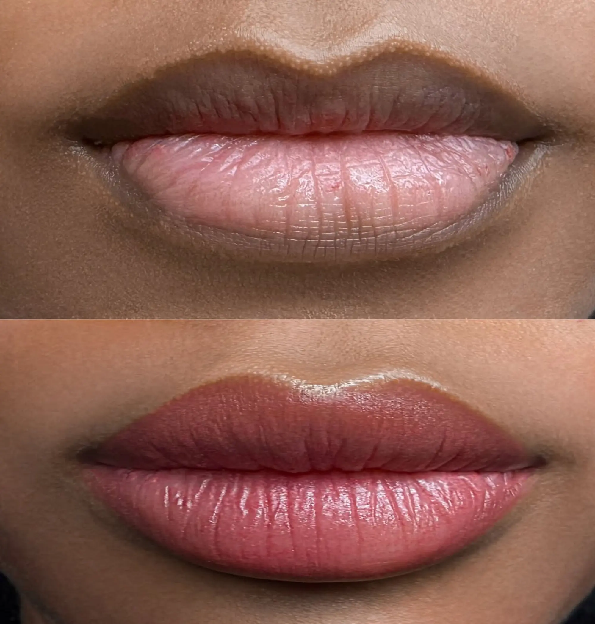 close up dark lip pigmentation details