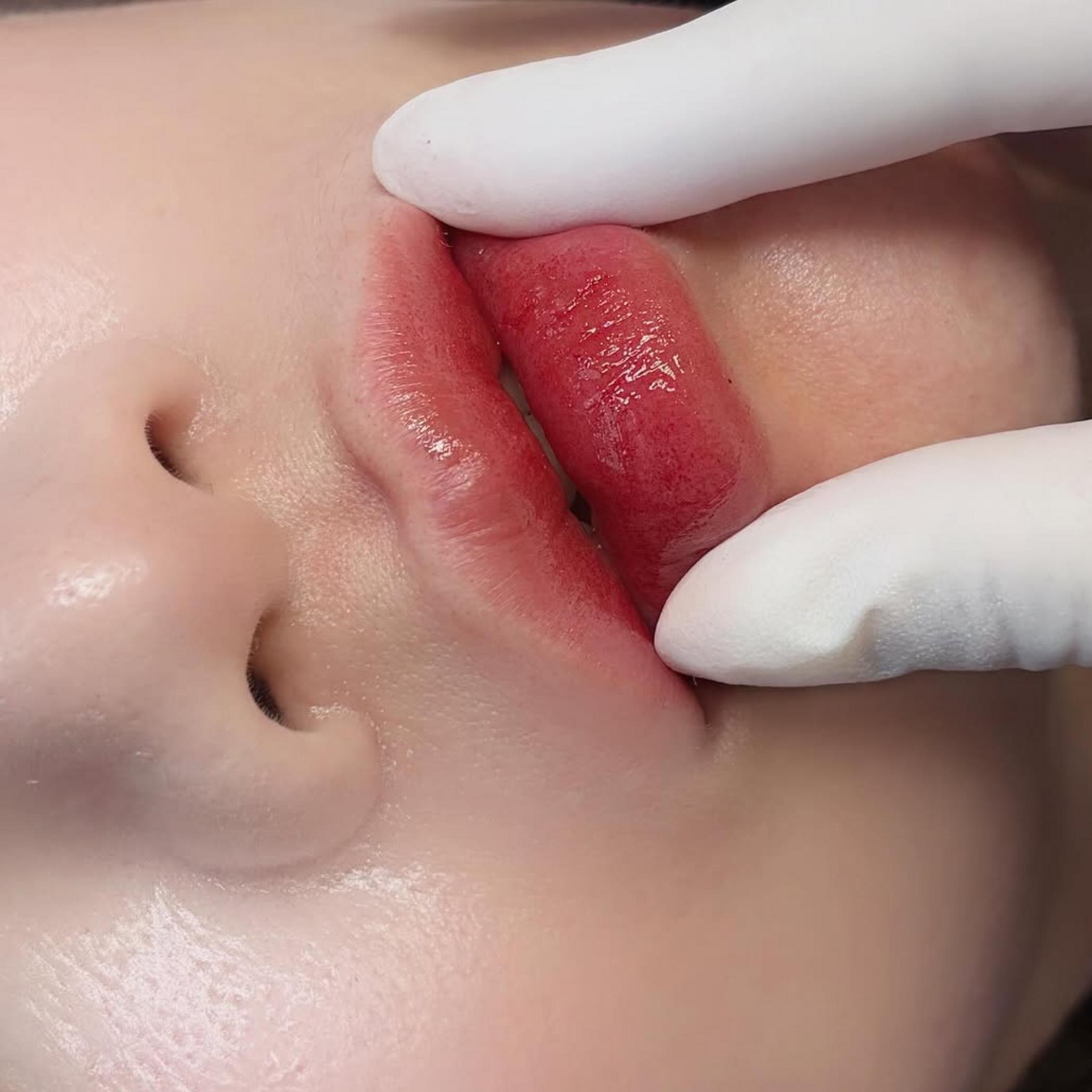 close up ford yce spots on lips