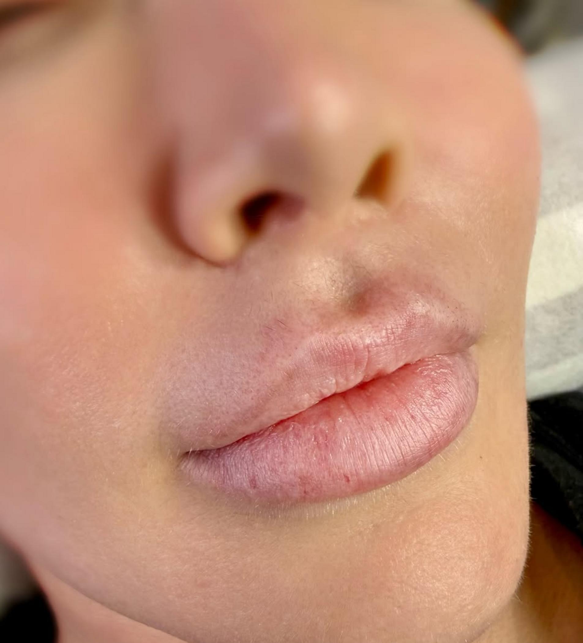 Do Teeth Whitening Strips Fade Lip Blush?