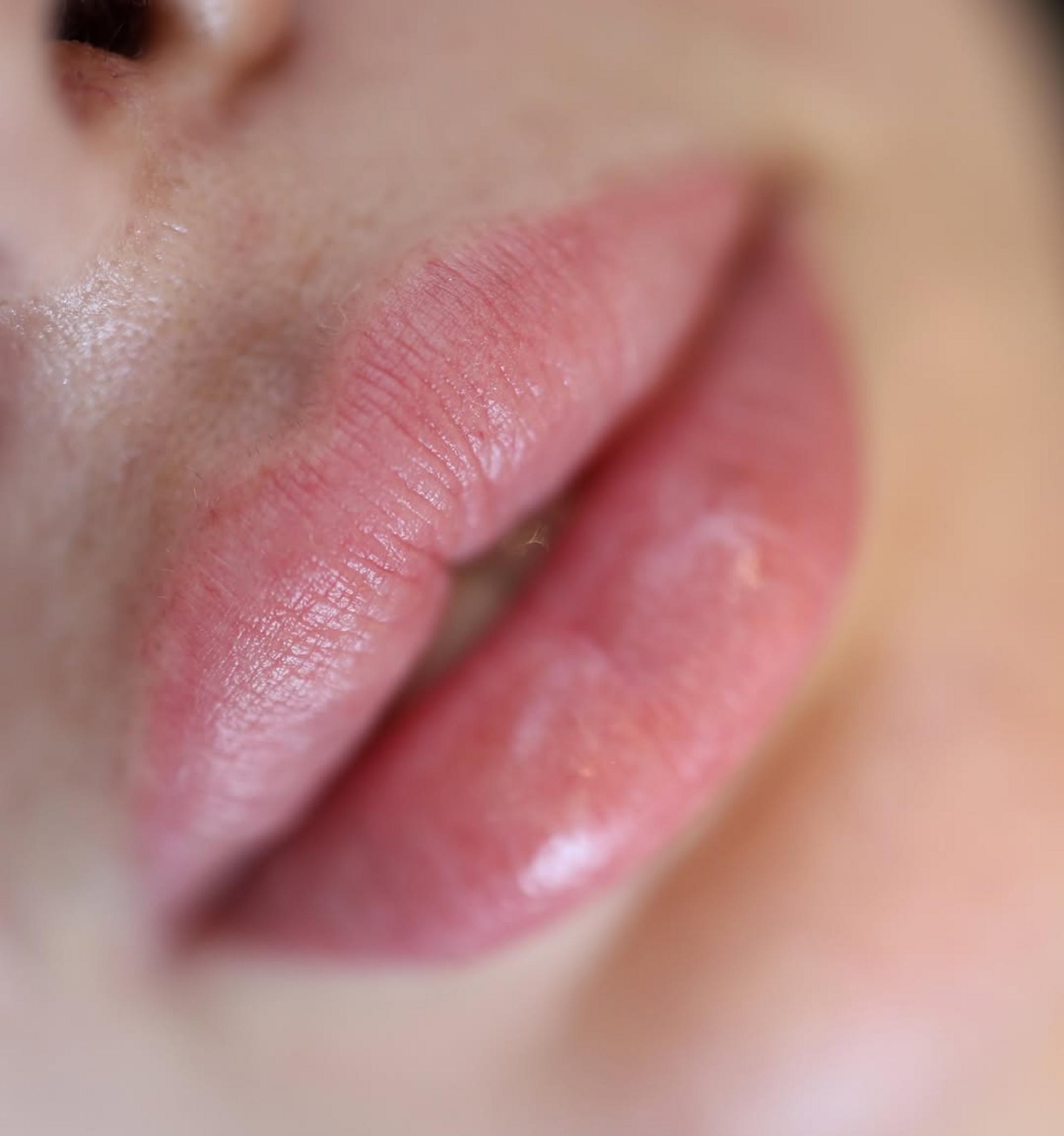 correction of uneven lip tattoo