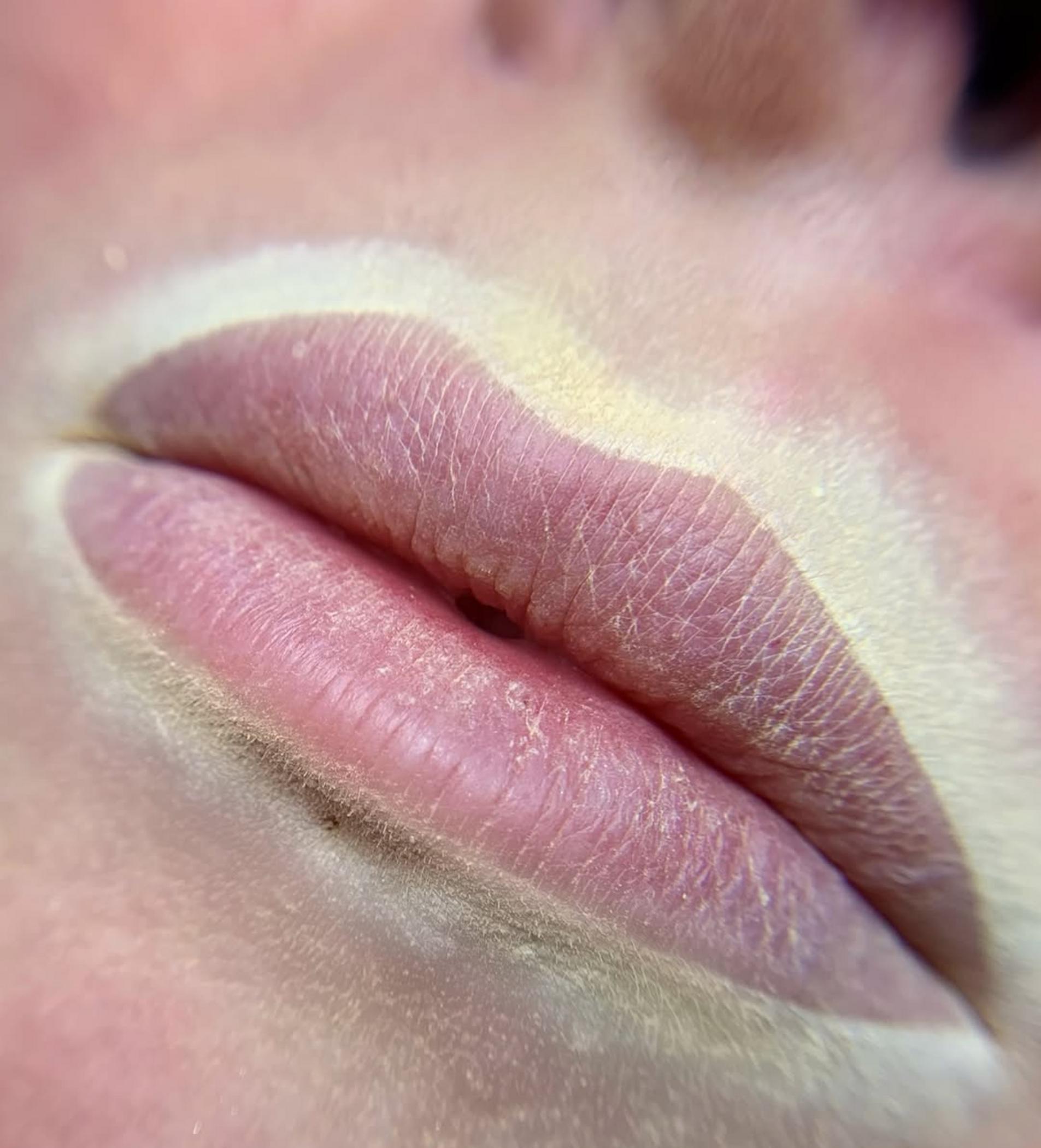 healing lip tattoo flaky skin stage