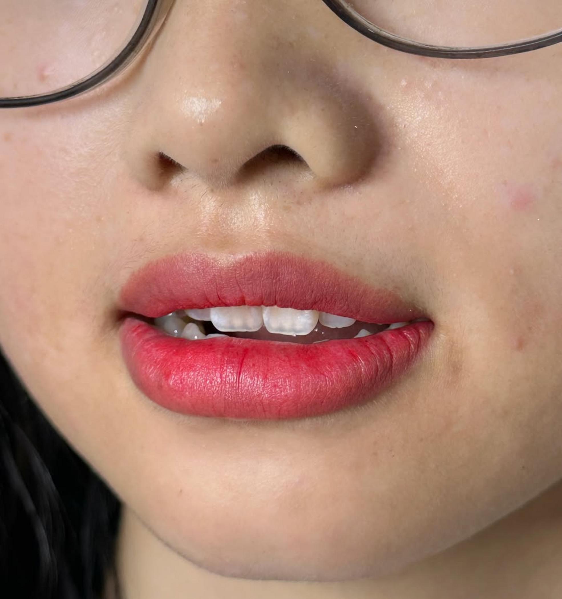 healing stages of lip tattoo
