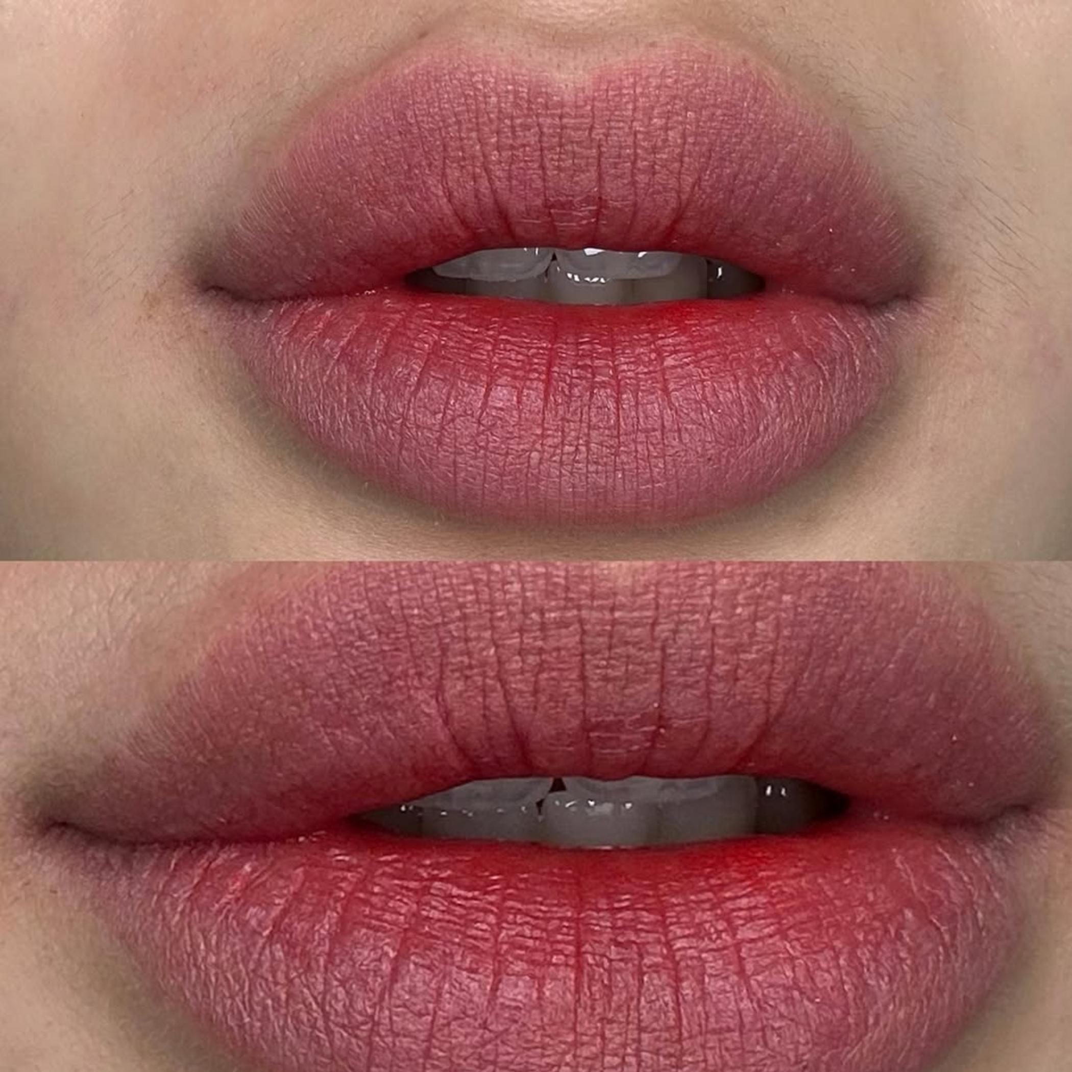 lip blush procedure in progress