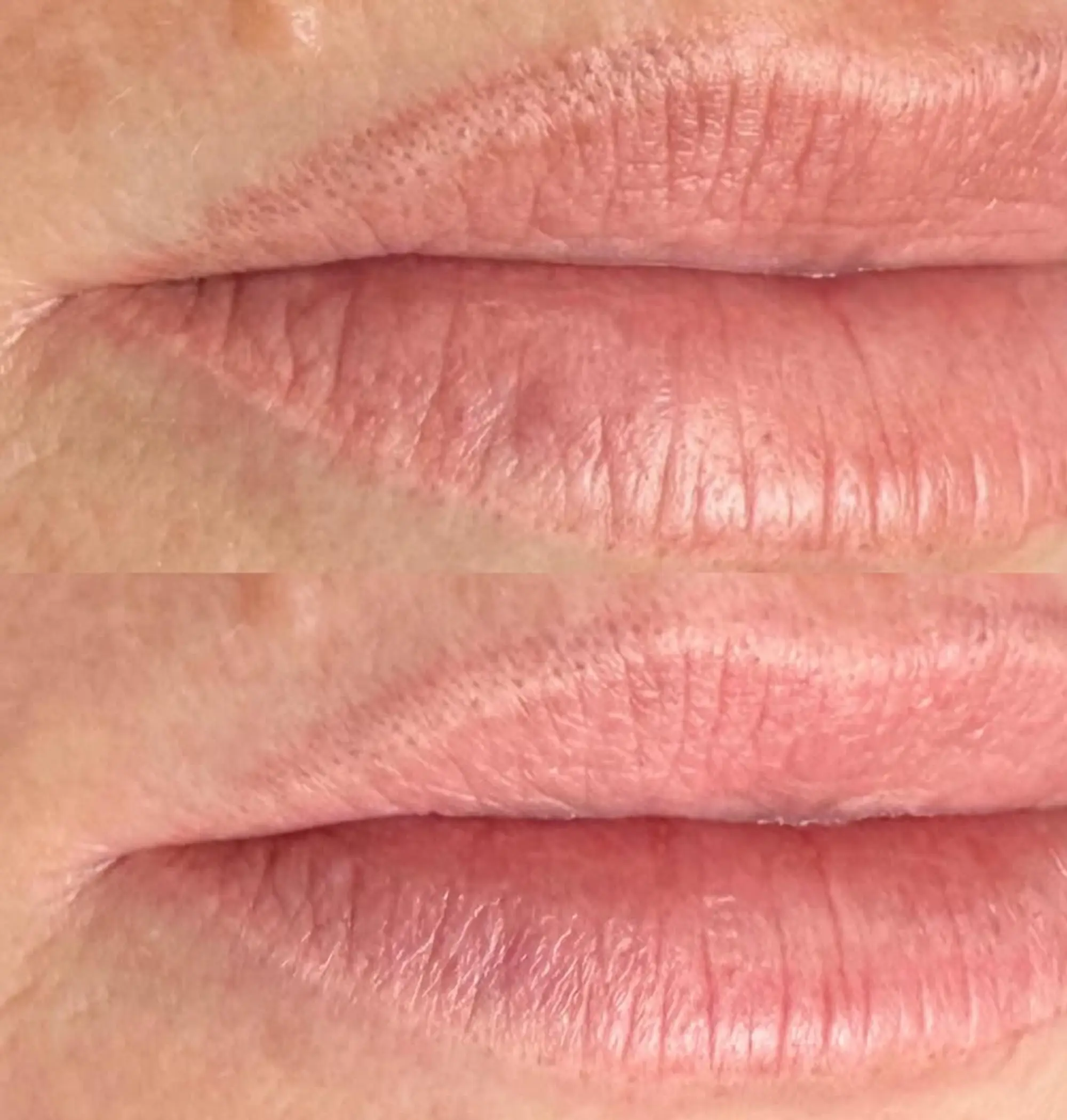lip blush tattoo numbing process