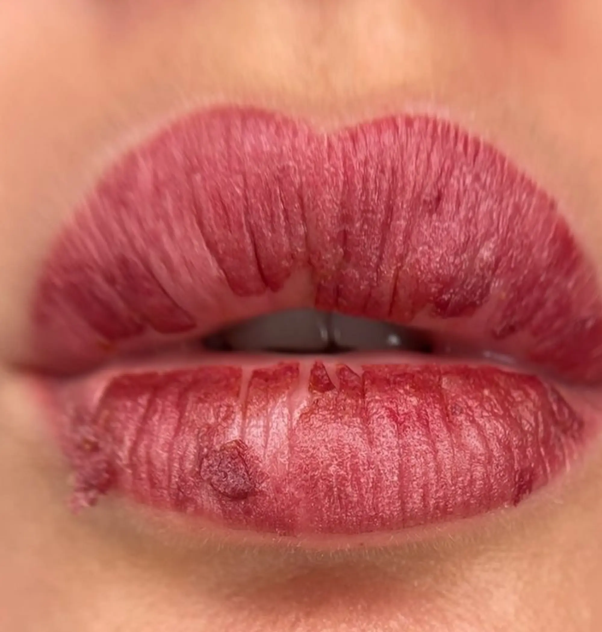 lip symmetry shaping with marker pen