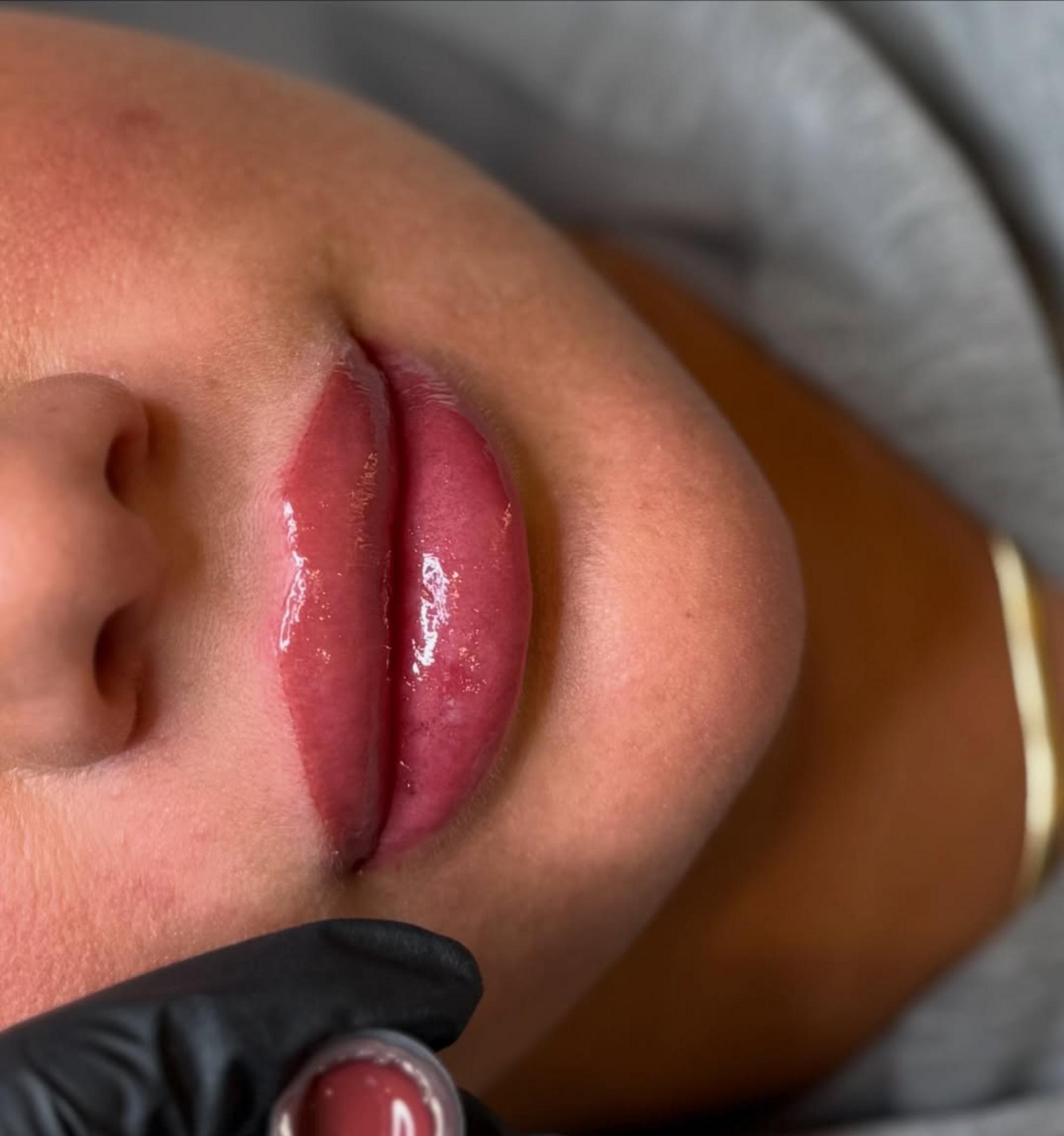 lip tattoo procedure in progress