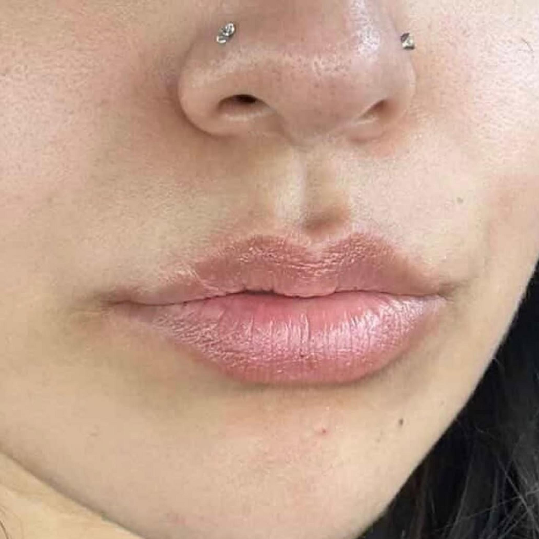 natural healed lip blush result