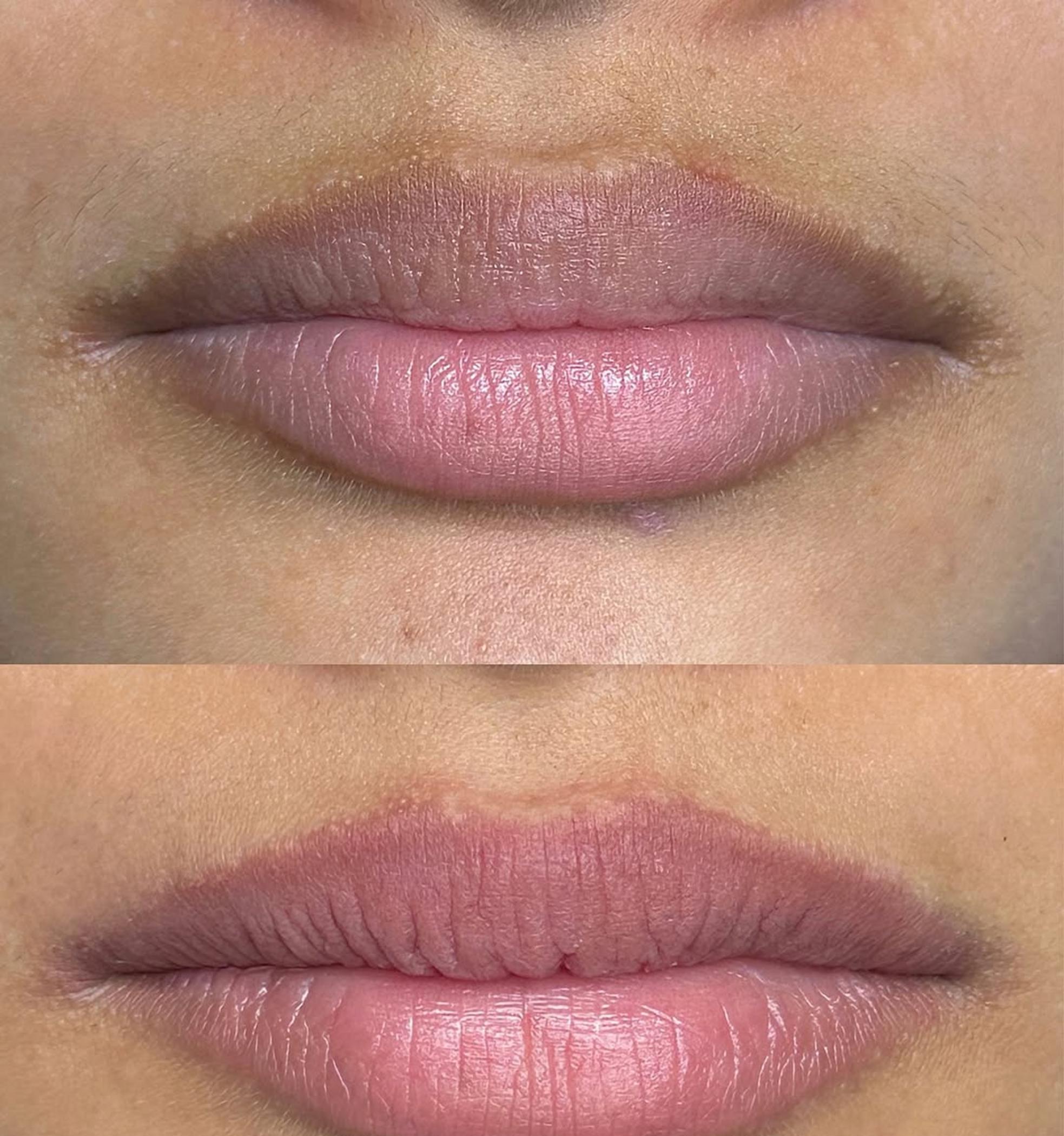 natural lip tint after tattooing