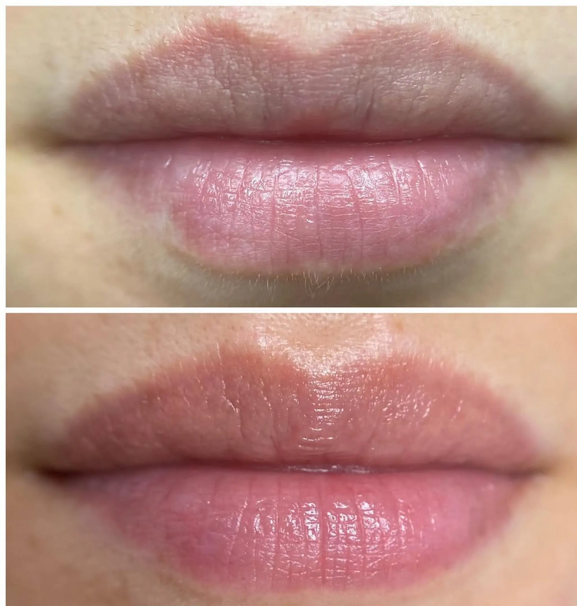 realistic post procedure eyebrow redness