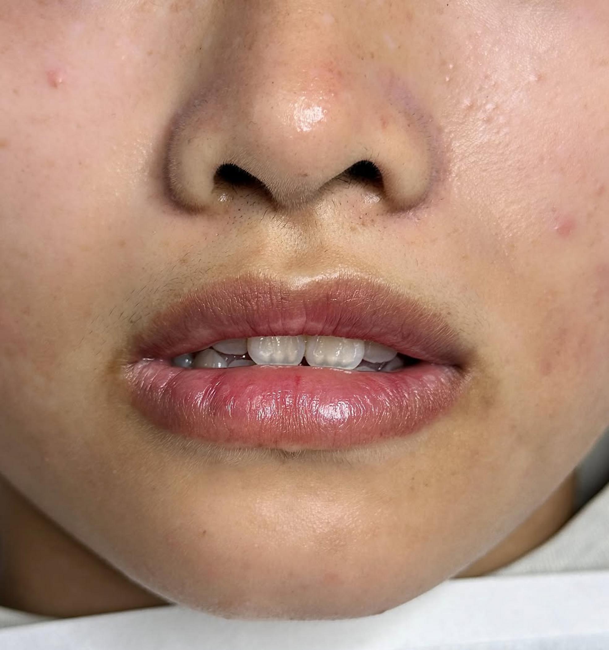 technician applying permanent lip color